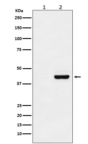 Western blot analysis of Myc-tagged protein expression in (1) 293T cell lysate; (2) 293T cell transfected with Myc-tagged protein lysate.